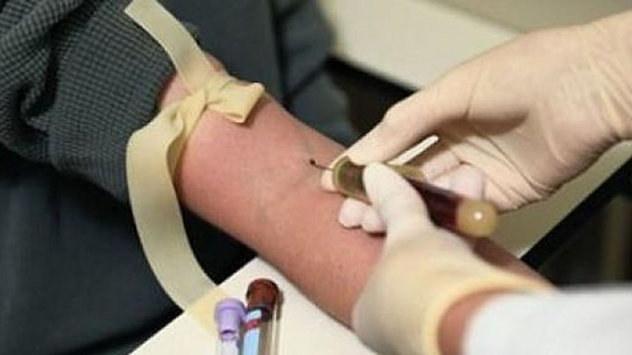 Kan Testiyle Kalp Krizi Riski Tespit Edilebiliyor