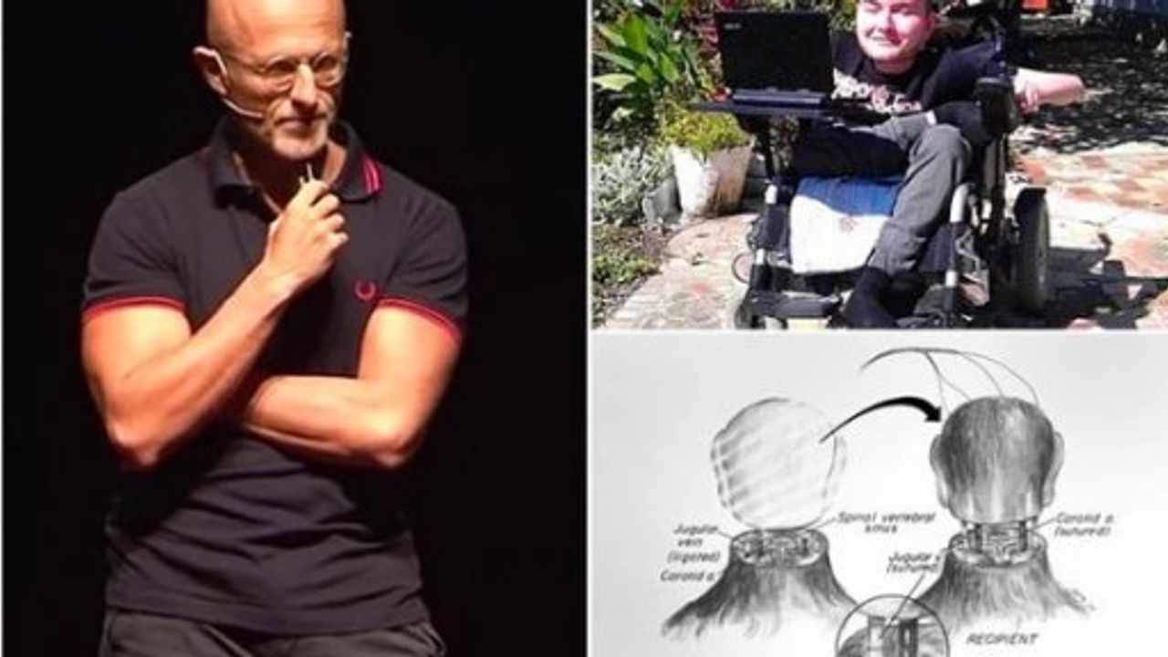 Geri Sayım Başladı! Dünyanın İlk Kafa Nakli Ameliyatı 8 Ay Sonra Gerçekleştirilecek
