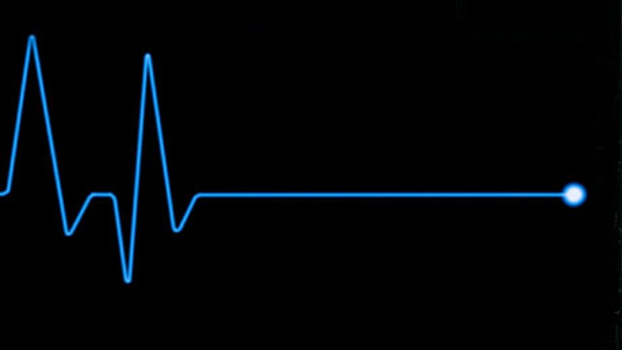 Demir’in Ölüm Sebebi “Kalp Hastalığı, Kalp Yetmezliği, Kalp Krizi Ve Düşme Sonucu Kafa Kemikleri Kırığı Ve Beyin Kanamas