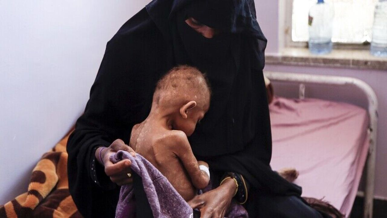 BM'den Yemen'de 18 milyondan fazla insanın şiddetli açlık çektiği uyarısı