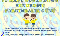 Altuğra: "Down sendromlu bireylerimize destek olmak bizlerin sorumluluğudur"
