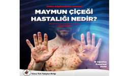 Tabipler Birliği, maymun çiçeği hastalığına ilişkin Zoom toplantısı düzenleyecek