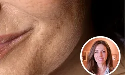 Ne Güneş Ne de Genetik! Cildi En Hızlı Yaşlandıran Hata Ortaya Çıktı