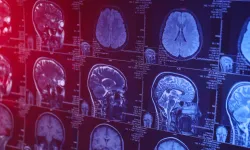 8 yıllık araştırma sonuçlandı. İşte demans riskini yüzde 40 azaltan aktivite