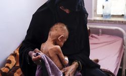BM'den Yemen'de 18 milyondan fazla insanın şiddetli açlık çektiği uyarısı