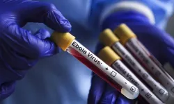 Kongo Demokratik Cumhuriyeti'ndeki Ebola salgınında can kaybı sayısı 1405'e yükseldi