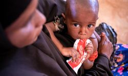 UNICEF, insani yardımların kesildiği Somali'de en büyük bedeli çocukların ödediğini bildirdi