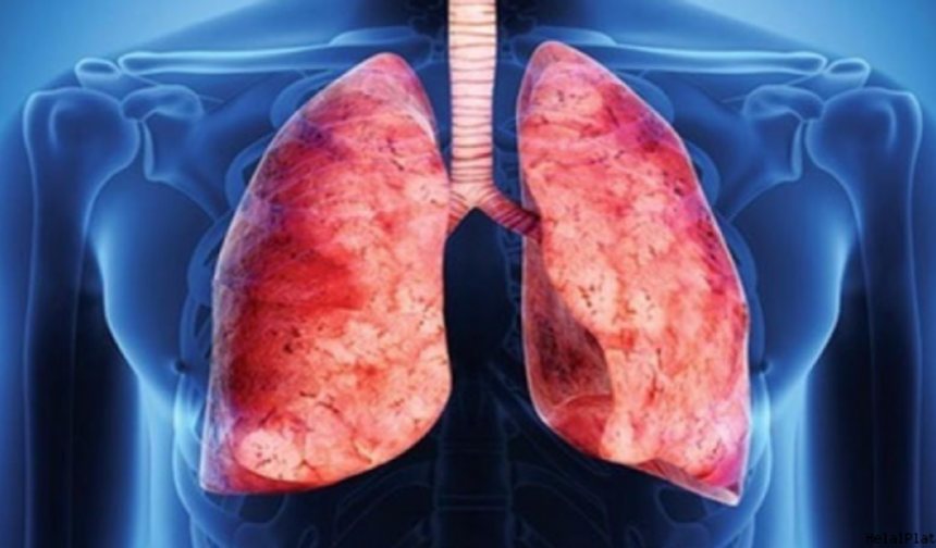 Akciğer sağlığı insan sağlığının devamlılığı açısından oldukça önemli bir organ. Peki biz akciğerlerimize ne kadar bakıyoruz? İşte akciğerinizi temizleyecek yiyecekler…

Akciğer kanseri dünyada 1 milyon 300 bin kişinin ölümüne sebep oluyor. Her nefesimizde oksijen almamızı sağlayan akciğerlerimiz vücudumuz için hayati önem taşıyor.

Bu nedenle beslenmemize ekleyeceğimiz bir takım gıdalarla akciğerlerimizi temizleyerek toksinlerden arınmasını sağlayabiliriz.

İşte akciğerlerimizi temizlemeyen ve toksinlerden arındıran o besinler…