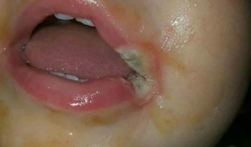 Dakikalar Sonra Çocuğunun Başına Bakın Ne Geldi

Çocukları olanlar, onları evdeki tehlikelerden korumak için neler yaptıklarını çok iyi bilirler.Çocuğunuza zarar gelmesin diye elinizden gelen her şeyi yapsanız da maalesef ufak tefek kazalar meydana gelebiliyor.Courtney Davis ismindeki bir annenin hemen her gün kullandığı şarj aleti çocuğunun başına bakın neler getirdi.Evde çocuk olduğundan dolayı Courtney, hemen her an prizde takılı kablo bırakmıyordu. Bir gün şarj aletini prizden çıkarmayı unuttu.19 aylık Gabby takılı olan şarj aletinin ucunu ağzına soktu.