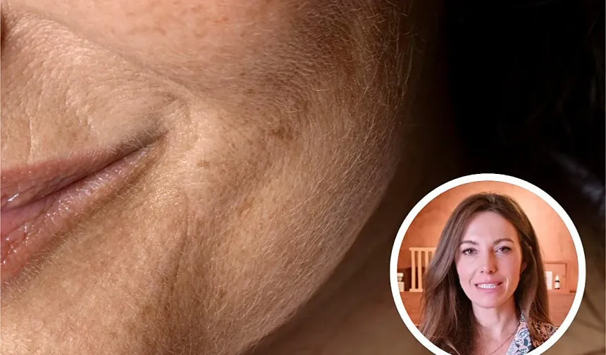 Ne Güneş Ne de Genetik! Cildi En Hızlı Yaşlandıran Hata Ortaya Çıktı