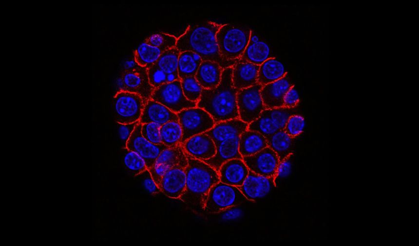 "Sessiz katil"e karşı yeni umut: Mekanizma bozulunca tümörler küçüldü