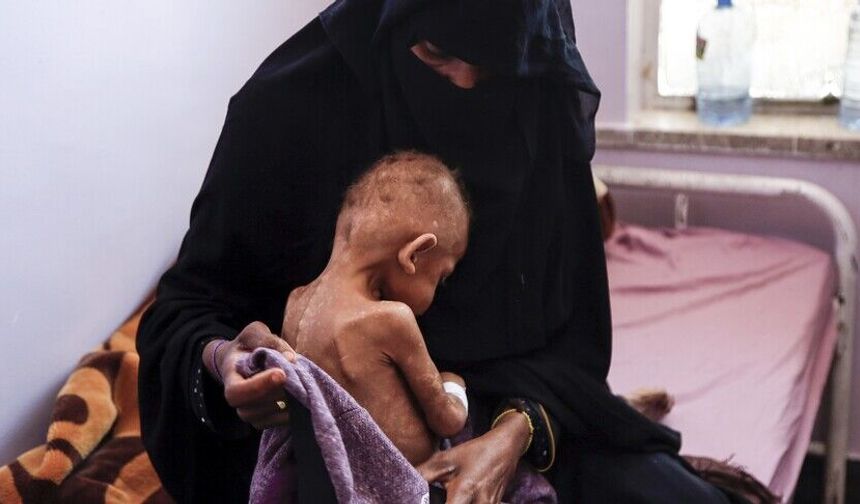 BM'den Yemen'de 18 milyondan fazla insanın şiddetli açlık çektiği uyarısı