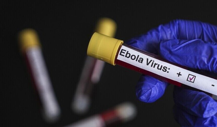 DSÖ: "KDC'de Ebola salgınında durum ciddiyetini sürdürüyor"